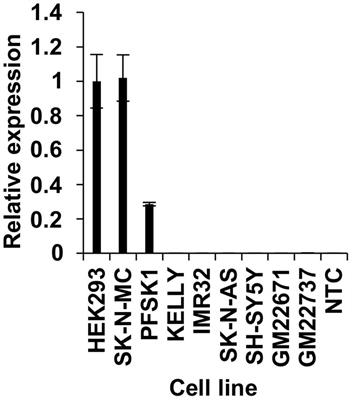 Mapping of Human FOXP2 Enhancers Reveals Complex Regulation
